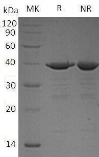 Recombinant Human D-Amino-Acid Oxidase/DAO (N-6His)